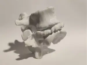 Vertebra Trauma