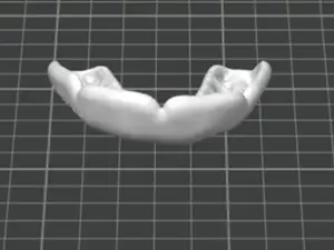 Mouthguard