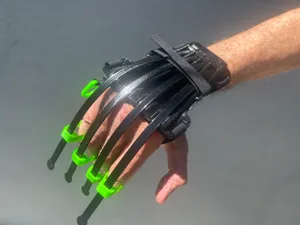 Wolverine Gauntlet: A Finger-Extension Exoskeleton