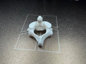 C2 (Axis) Human Vertebra Anatomically Correct