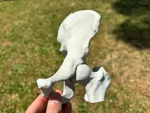 Real Human Hip (From CT scan)