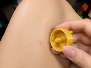 Addictive Itchy Skin Scratcher Portable LifeSaver!