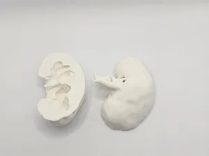 Left Kidney anatomical model (CT Scan)