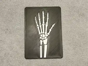 x-ray of a hand