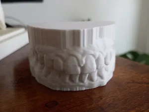 Arco dental real para protesis
