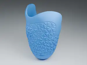 Patterned Prosthetic Socket Design