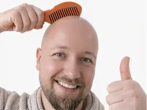 Glatzenkamm