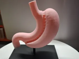 Anatomisches Schlauchmagen-Modell mit Sockel (FDM)