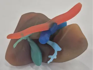 Real Liver Anatomy