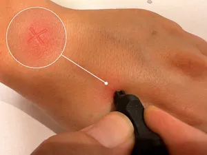 Mosquito X
