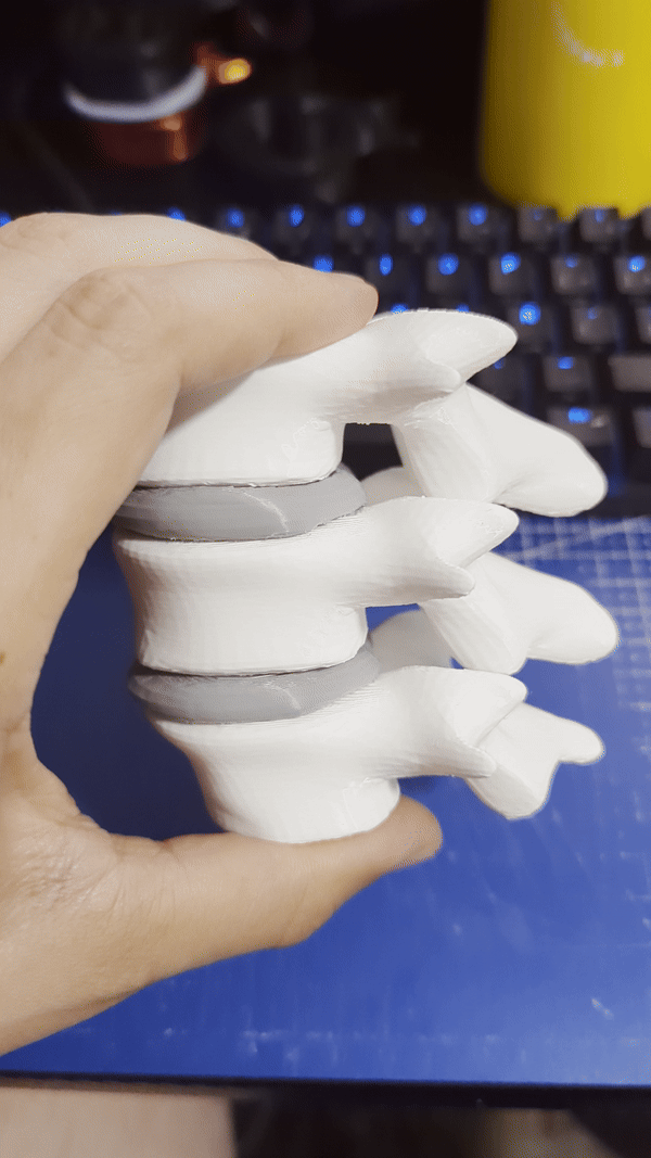 Vertebra from L3 to L5 with flexible discs