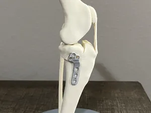 Canine TPLO Model