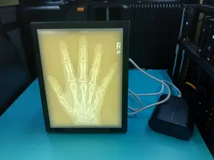 X-Ray - Right Hand - Lithophane - Medical Image