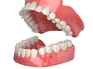 牙齿模型Tooth model
