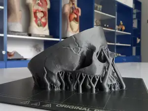 Anatomical Human Skull Model (Upper Part)