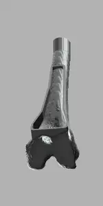 Distal Femur IO Trainer