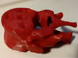Real human spinal vertebra - from CT scan