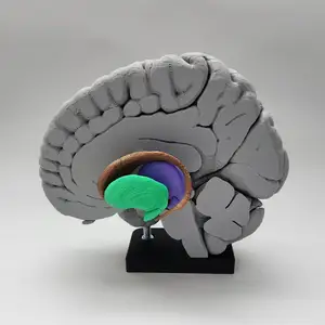 Basal Ganglia (Deep Brain Nuclei)