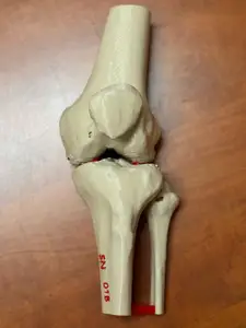 Human knee (distal femur, patella, proximal tibia, proximal fibula), anatomický model kolene