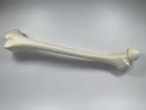 Left Human Femur