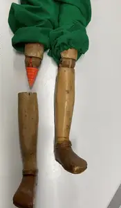 Repair of Knee Joint of the Christmas Holy King