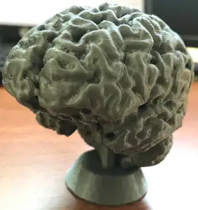 Brain