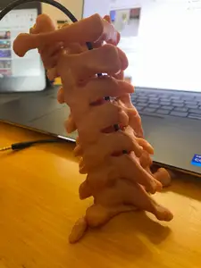 Cervical spine (c1 to c7)
