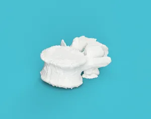 Vertebra