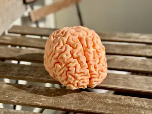 MRI Brain Scan