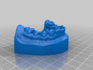 Set of teeth - dental model - 3D Scan (test with Raspi Cam)