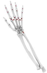 Life-sized Flexible Forearm