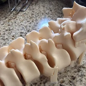 Column bone