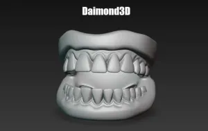 dentadura dentes