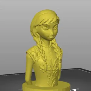 Anna frozen