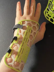 MOLDABLE QUICK BRACE