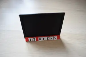 Baby Scan Modular Photo Frame